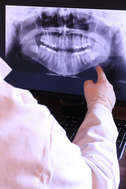 Best Emergency Dentist for Lost Fillings or Crowns in Westlake Corner, VA