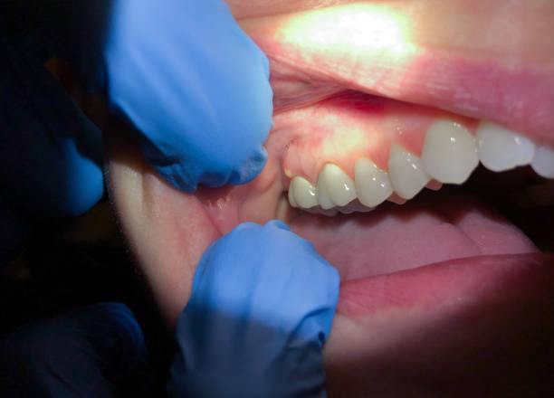 Best Urgent Dental Care for Toothache in Westlake Corner, VA